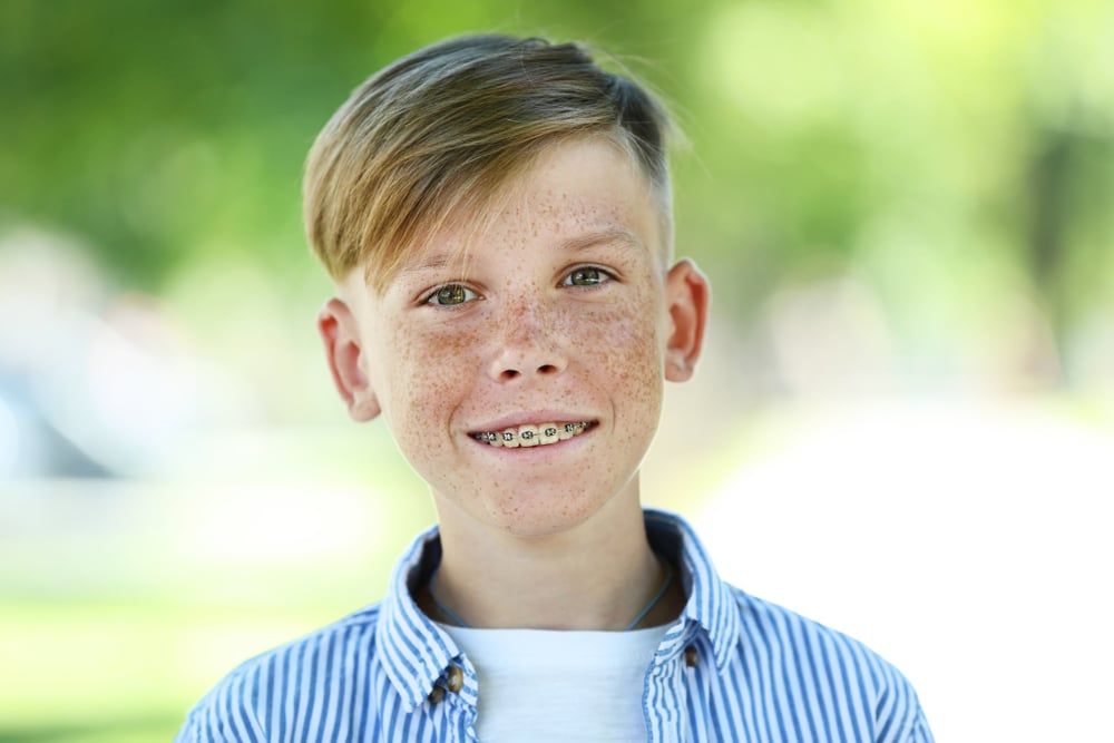 A boy with freckles is smiling for the camera.