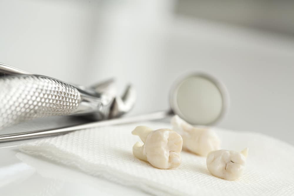 A pair of dental tools and a tooth on a napkin, showcasing the expertise of a cosmetic dentist.