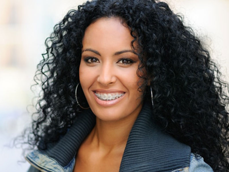 a woman in braces smiling