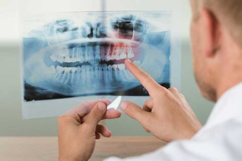 Tooth xray